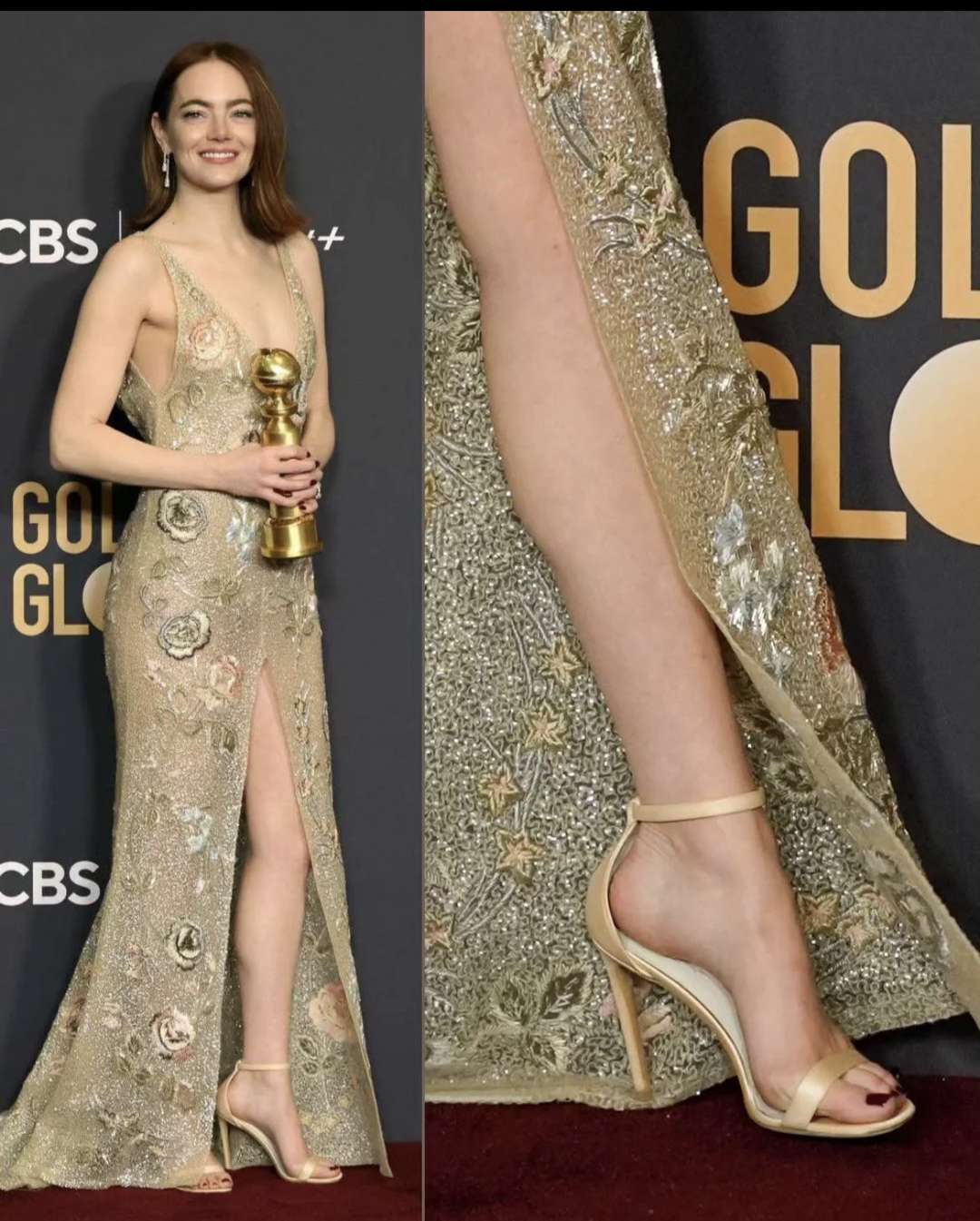 Emma Stone Legs